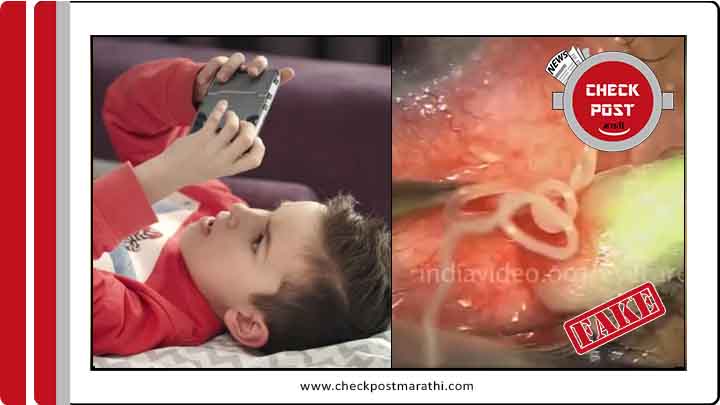 Over gaming can cause parasite worm in eye claim is fake check post mararhi fact