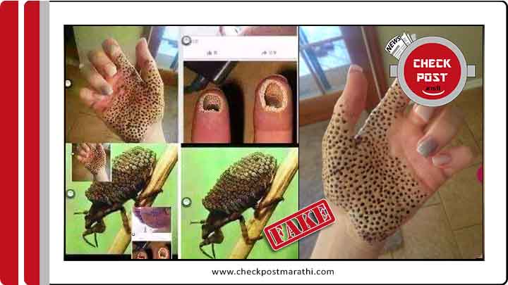 killing insect by hand can cause pores on the body claims are fake checkpost marathi fact